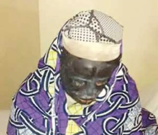 Couple bathed with acid while making love in Kano (Graphic photo)